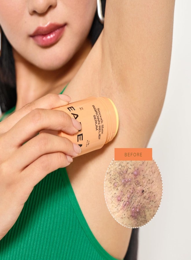 سيروم إيديم سموث سلات لعلاج الشعر النامي تحت الجلد، يستهدف النتوءات والشعر المحصور، ويعالج آثار الندبات والبقع الداكنة الناتجة عن العلاجات الموضعية، ويحتوي على أحماض ألفا هيدروكسي وإنزيم التيروزيناز، ويبطئ نمو الشعر النامي تحت الجلد. - Image 2