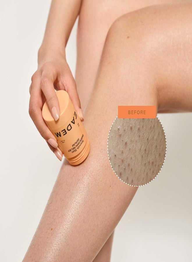 سيروم إيديم سموث سلات لعلاج الشعر النامي تحت الجلد، يستهدف النتوءات والشعر المحصور، ويعالج آثار الندبات والبقع الداكنة الناتجة عن العلاجات الموضعية، ويحتوي على أحماض ألفا هيدروكسي وإنزيم التيروزيناز، ويبطئ نمو الشعر النامي تحت الجلد. - Image 4