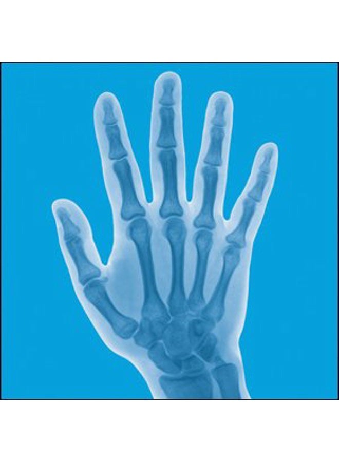 Lindberg Ultrajoint 210 Capsules - A Comprehensive, Triple-Action Joint Formula (99-235) - Image 4