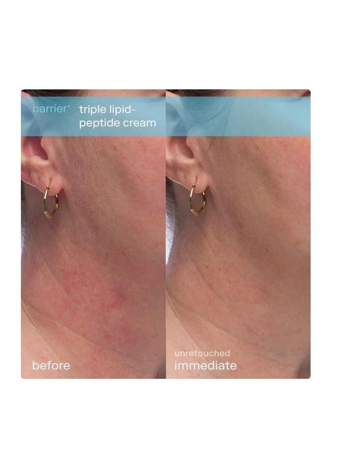 Skinfix - Barrier+ Triple Lipidpeptide Refillable Face Cream 1.7 Oz/ 50 Ml Refill - Image 1
