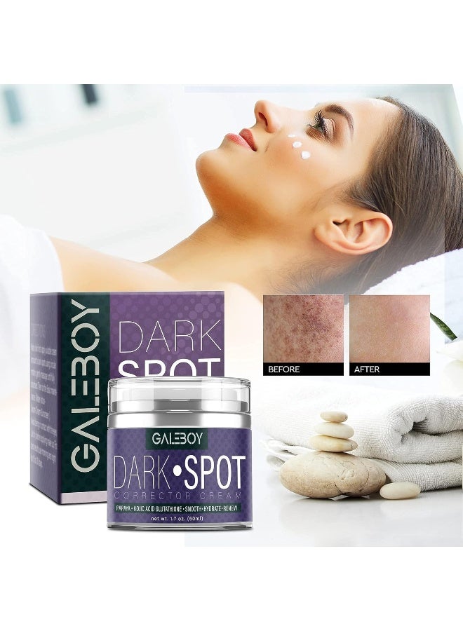 Galeboy Dark Spot Corrector Cream - Image 5