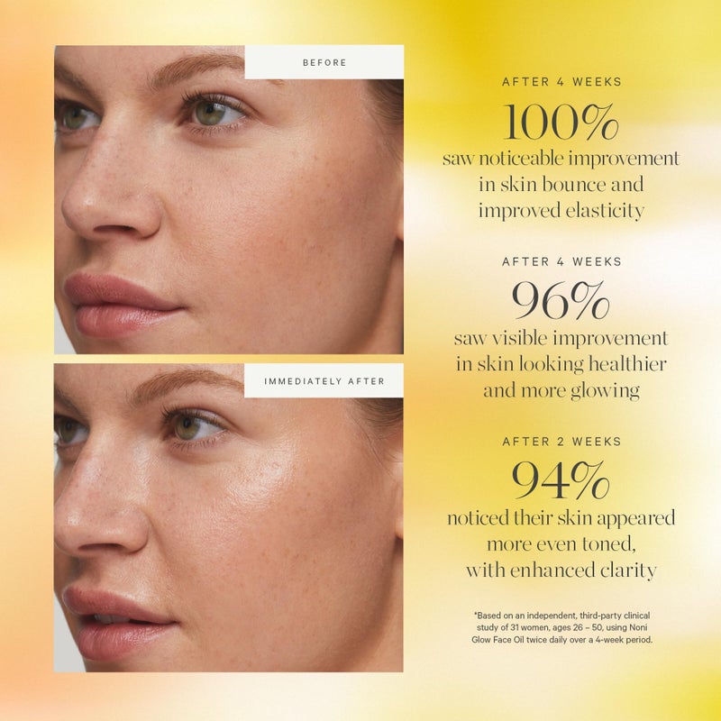 KORA Organics Noni Glow Hydrating Face Oil with Antioxidants, Nourish & Illuminate, Certified Organic, Cruelty Free, 0.34 fl oz - Image 4