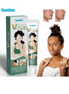 Sumifun Vitiligo Relief Cream 20G, Treatment for Skin Vitiligo Ointment, Fade White Spot and Improve Skin Pigmentation Cream, Vitiligo Cream for Skin Healthy Care  - Image 1