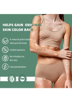 Sumifun Vitiligo Relief Cream 20G, Treatment for Skin Vitiligo Ointment, Fade White Spot and Improve Skin Pigmentation Cream, Vitiligo Cream for Skin Healthy Care  - Image 5