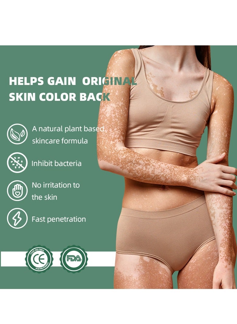 Sumifun Vitiligo Relief Cream 20G, Treatment for Skin Vitiligo Ointment, Fade White Spot and Improve Skin Pigmentation Cream, Vitiligo Cream for Skin Healthy Care - Image 5