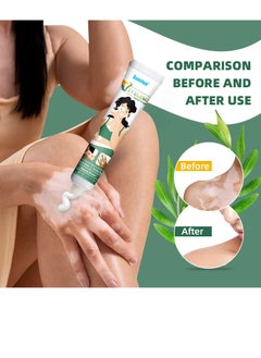 Sumifun Vitiligo Relief Cream 20G, Treatment for Skin Vitiligo Ointment, Fade White Spot and Improve Skin Pigmentation Cream, Vitiligo Cream for Skin Healthy Care  - Image 2