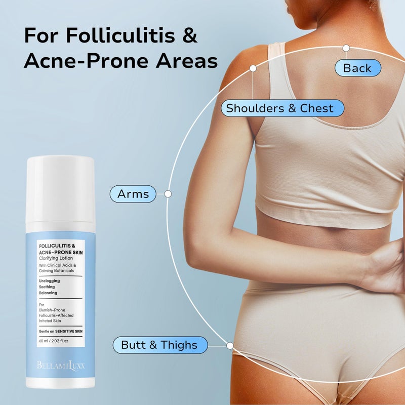 BellamiLuxx Folliculitis Acne Lotion for Body: Helps Reduce Itch, Redness, Body Acne, Bumps & Uneven Texture with Salicylic & Glycolic Acid + Botanicals - Gentle Care for Folliculitis-Prone Skin - Image 4