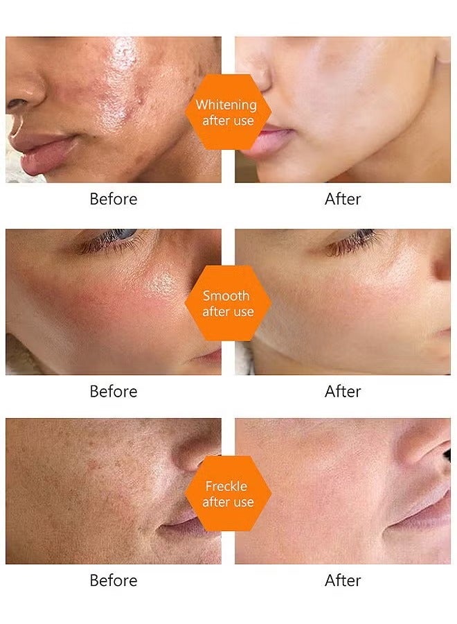 WEST MONTH Turmeric Dark Spot Corrector Toner 100ML Facial Toner For Acne Prone Skin Dark Spot Remover For Face Hydrating Face Toner For Women Treatment - Image 5