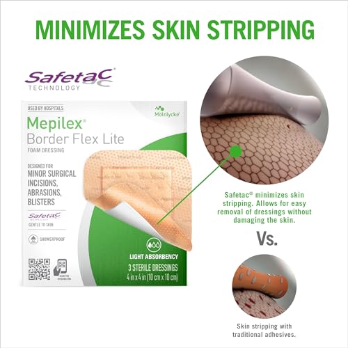 Mepilex Border Flex Lite 4x4 in (10x10 cm) Hospital Grade Dressings for Minor Surgical Incisions, Abrasions and Blisters for up to Several Day Use - Image 3