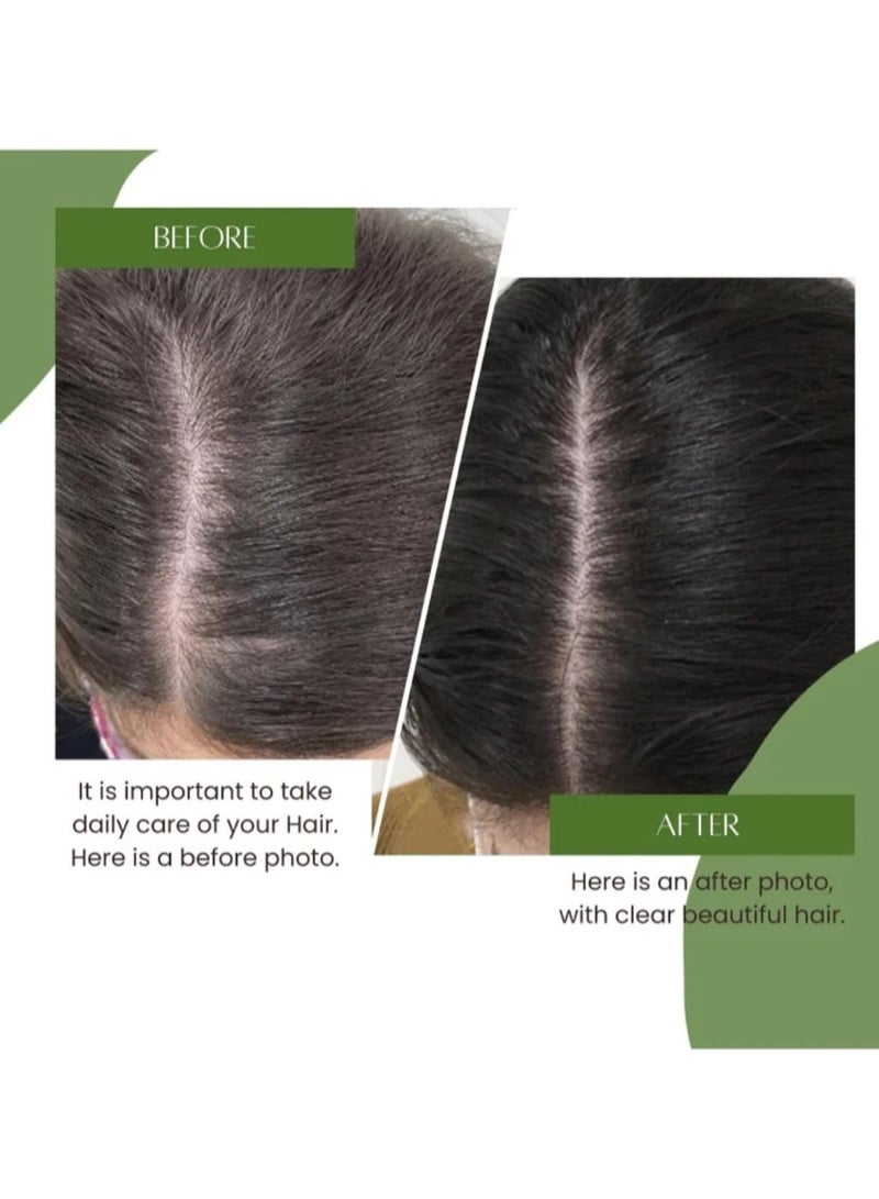 OGAILI Sidr Al Yeman Powder Natural Herbal Hair Cleanser Rejuvenates Hair follicle Stimulate Hair Growth Fights Fungus & Scalp Bacteria Control Hair Fall & Reduce Dandruff 180gm - Image 3