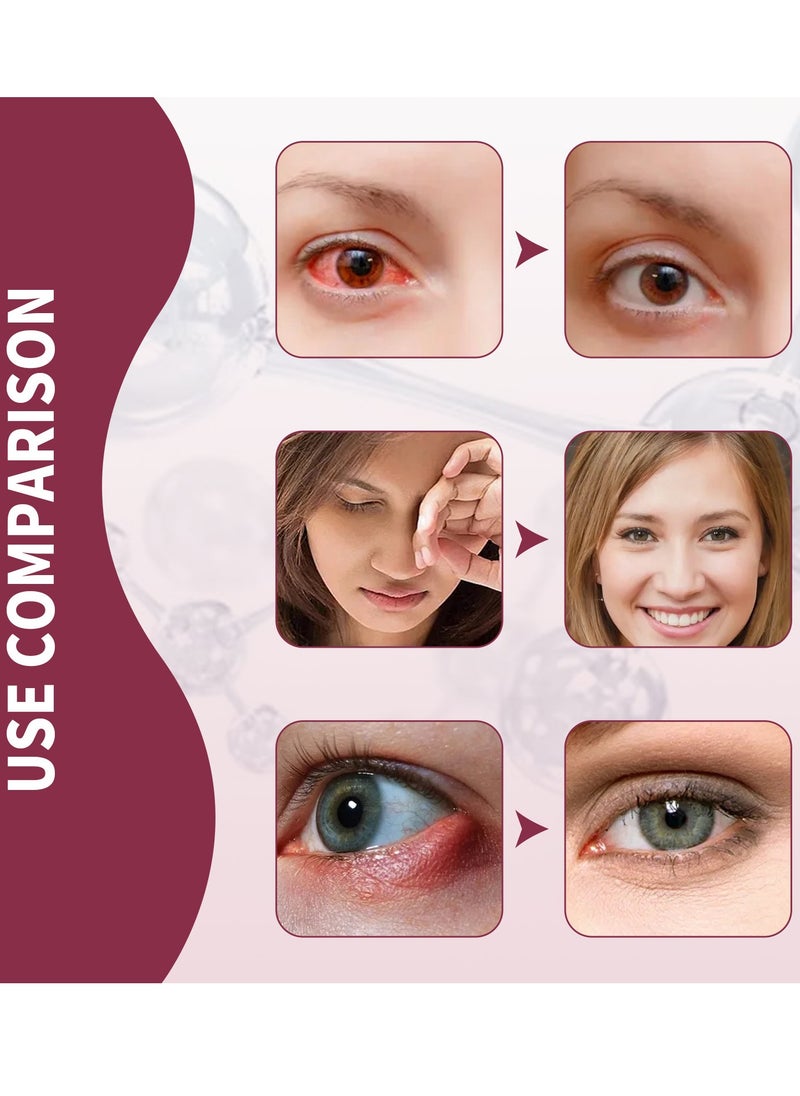 Jaysuing - Seye Eye Relief Serum for Relieve Eye Redness and Swelling and Moisturize Eye Area - Image 1