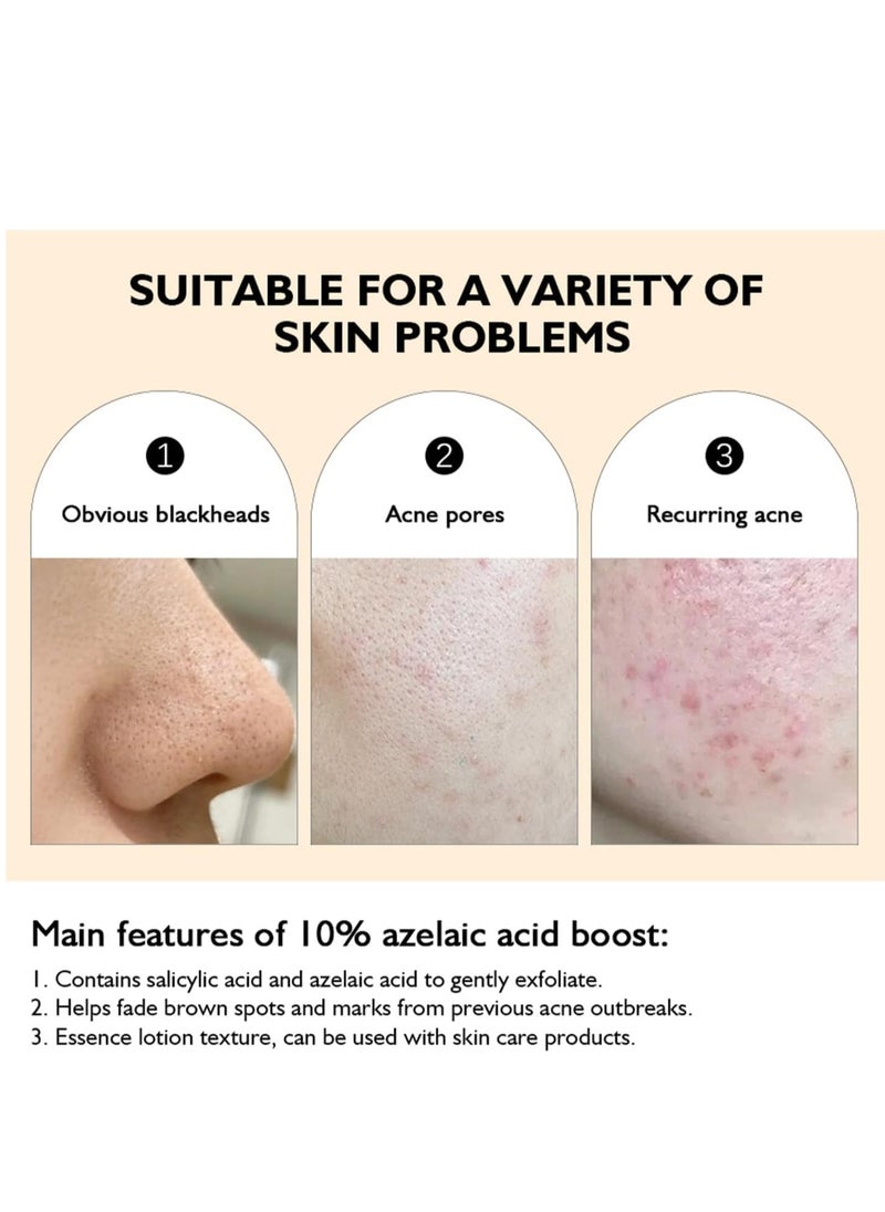 lakerain - Azelaic Acid Serum 10% with Licorice Root (30ml), Lightweight Formula for Uneven Skin Tone, Dark Spots, and Acne Marks – Refines Skin Texture, Reduces Pimple Breakouts, Blackheads, Pigmentation - Image 1
