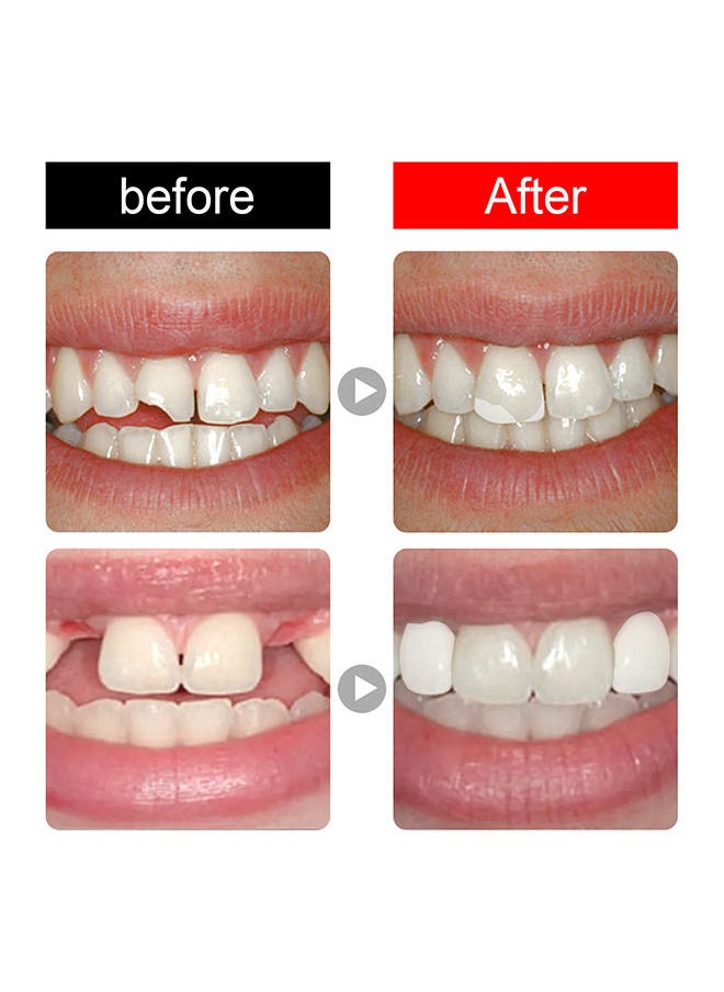 Jaysuing - Tooth Repair Kit, Dental Care Kit for Filling Missing, Broken Teeth, Crowns and Bridges, Moldable Fake Teeth Suitable for Men and Women - Image 1