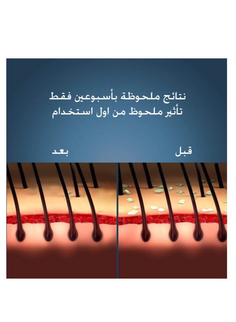 نيزورال نيزورال 3 عبوات شامبو لعلاج قشرة الشعر 100مل  - Image 5