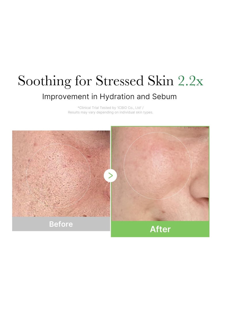 ميديكيوب كريم ميديكوب إكسوسوم سيكا شجرة الشاي للبشرة الحساسة - Image 5