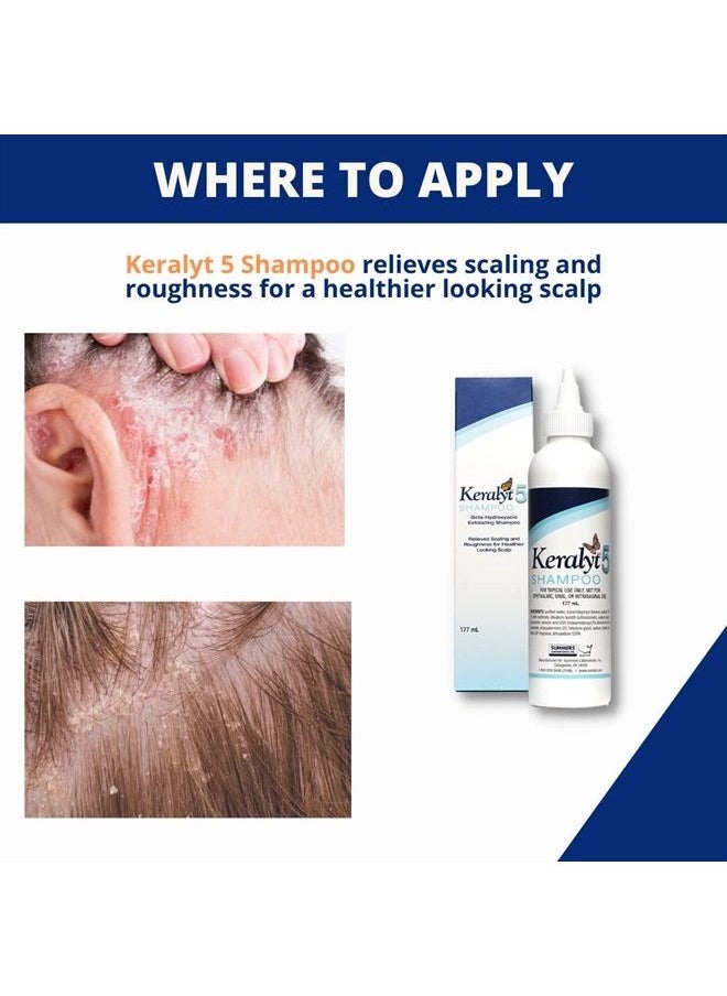 keralyt - 5 Anti-Dandruff Shampoo - Max Strength 5% Salicylic Acid Scalp Build-Up Clearing - Promotes Relief from Dandruff, Psoriasis, Seborrheic Dermatitis, Dryness, and Itchiness - Image 1