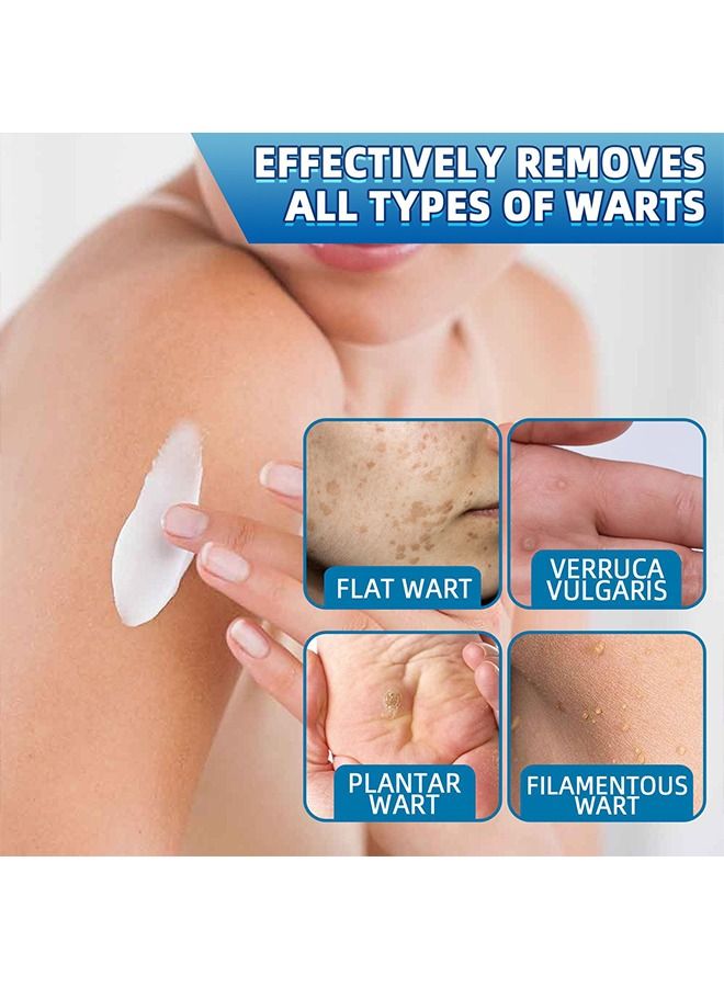 Jaysuing 20g Skin Tag Wart Removal Ointment - Plantar Warts  - Image 4