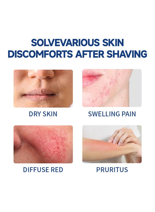 جايسوينغ مخفف نتوءات الحلاقة، سيروم رول أون للرجال والنساء، لتخفيف حروق الحلاقة لمنطقة البكيني، لوشن بعد الحلاقة لبشرة ناعمة وخالية من النتوءات 100 مل - Image 5