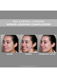 PETER THOMAS ROTH Peter Thomas Roth Firm X Peeling Gel  - Image 2