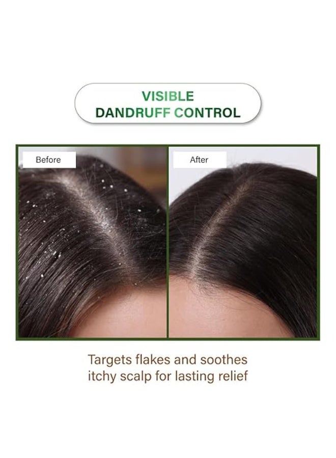 Niconi Herbal Hair Oil for Hair Fall and Dandruff Control, 200ml - Image 3