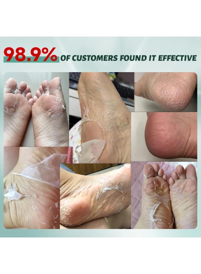 VGO VGO 7 Pack Foot Peeling Mask, Natural Exfoliating Foot Mask, Dead Skin Callus Remover Repair Heels, Smooth Touch Feet, Hydrating Foot Care for Dry Cracked Feet  - Image 3