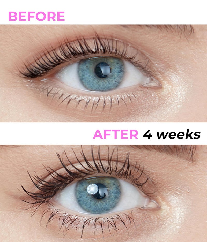 Stacy Lash Serum For Eyelash Growth And Thickness Eyelash Serum 5Ml Eyelash Growth Serum For Enhancing Natural LashesPremium Biotin Treatment - Image 2