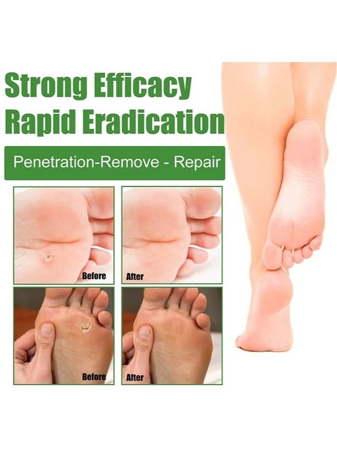 EELHOE 30 Pcs Wart Removal Pads, Treatment Relief Corn Pain and Foot Care, Clean Anti-Itting and Antibacterial Patches - Image 5