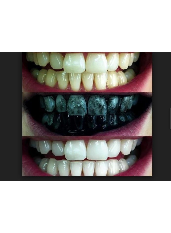 Complete Dental Care Bundle - Fresh Doctor Toothbrush + Activated Charcoal & Herbal Whitening Toothpaste (140ml) - Image 3