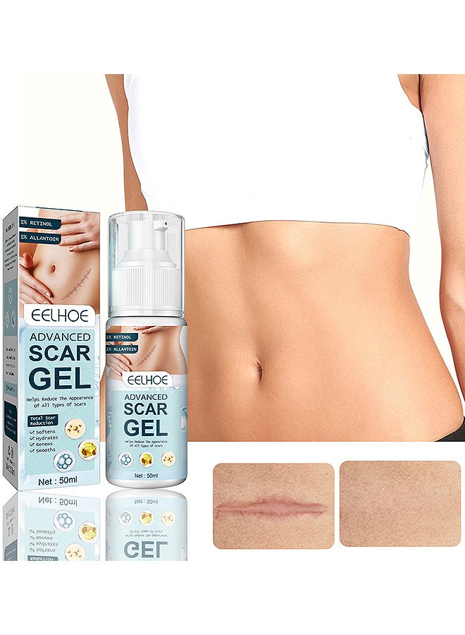 EELHOE Advanced Scar Gel, Medical Grade Scar Gel Advanced Scar Removal Gel For Surgical Scars Stretch Marks Acne Injury Burns Keloids Hypertrophic Old And New Scars 50ML - Image 1