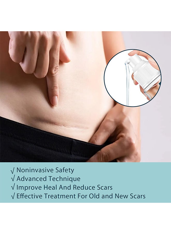 EELHOE Advanced Scar Gel, Medical Grade Scar Gel Advanced Scar Removal Gel For Surgical Scars Stretch Marks Acne Injury Burns Keloids Hypertrophic Old And New Scars 50ML - Image 4