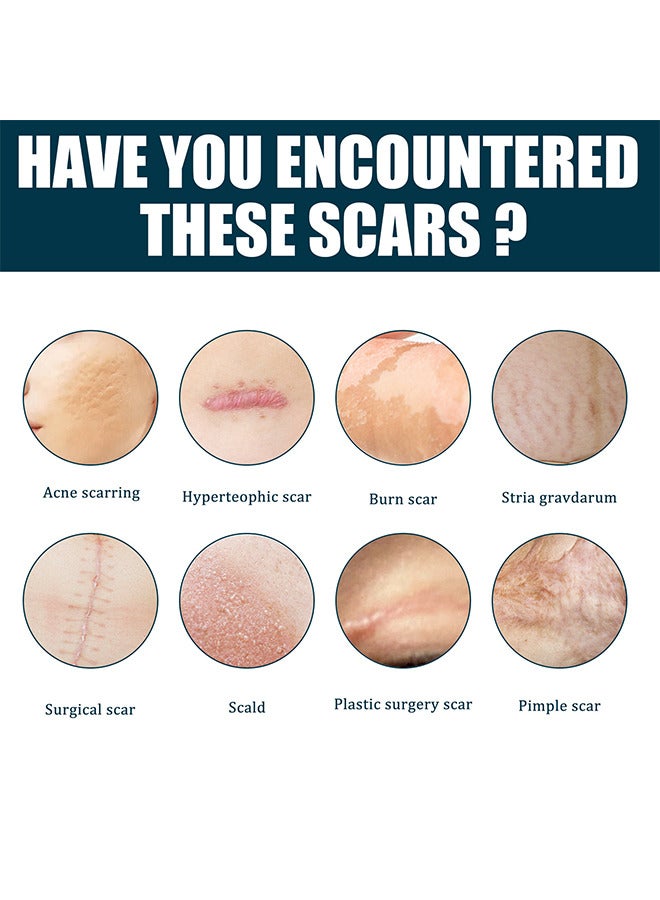 EELHOE Advanced Scar Gel, Medical Grade Scar Gel Advanced Scar Removal Gel For Surgical Scars Stretch Marks Acne Injury Burns Keloids Hypertrophic Old And New Scars 50ML - Image 5