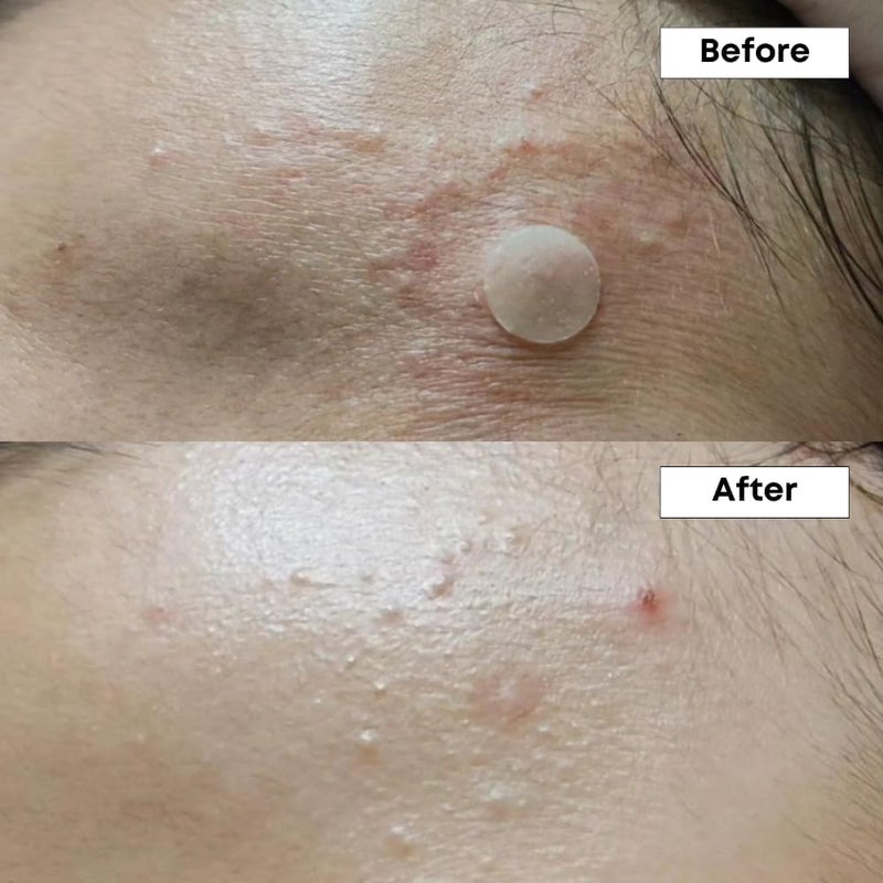 NINELESS A-Control 10% Azelaic Acid Serum - Image 3