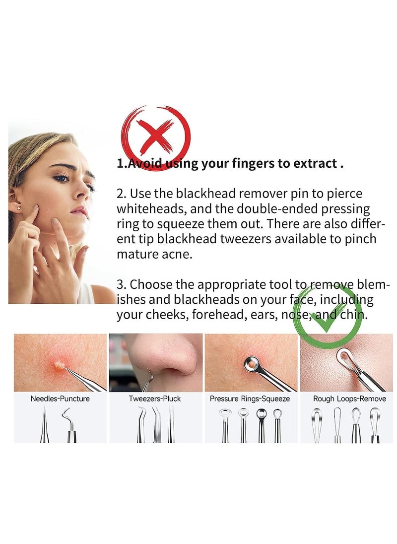 Generic - Pimple Popper Tool Kit, Professional Blackhead Remover Tools for Acne and Zit Popping Comedone Extractor 22 PCS - Image 1