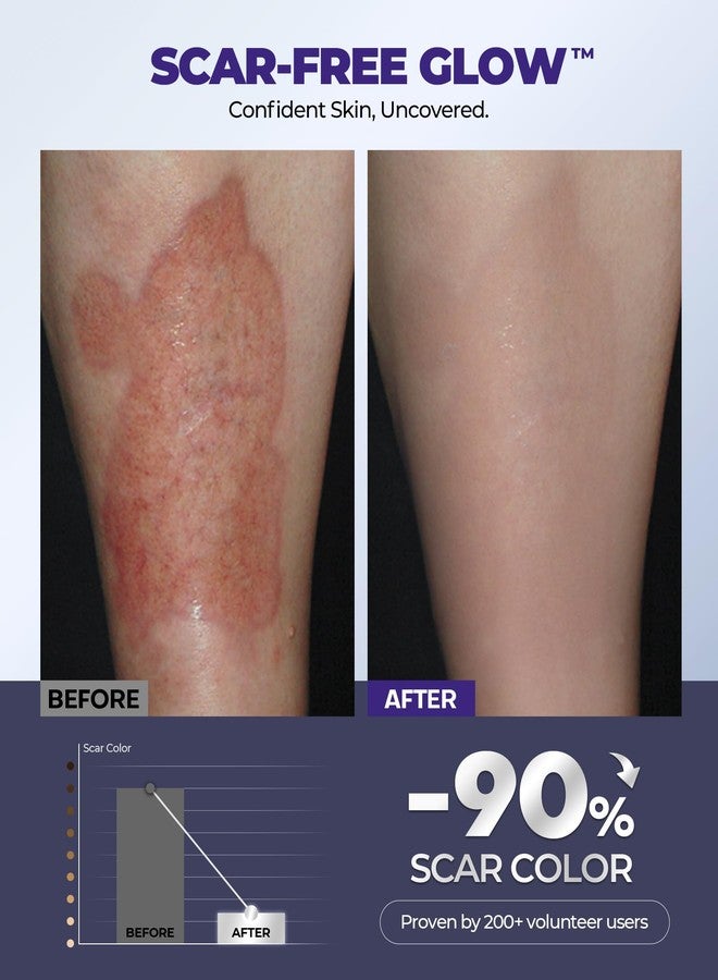 EASEWAVE Silicone Scar Cream with 6.7% Active Ingredients, Scar Gel Visible in 2 Weeks, Moisturizing Scar Removal Clinically Show for Surgical, C-Section, Keloid, Acne & Burn Scars, Stretch Mark Cream(55ML) - Image 5