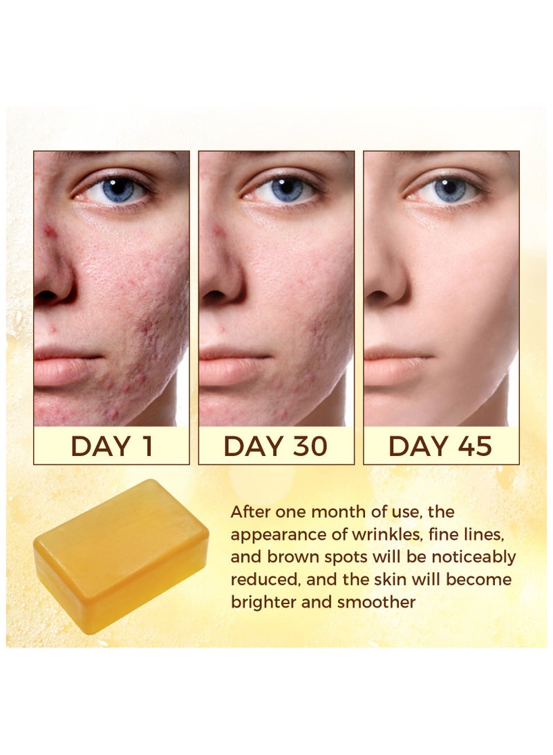 OUKEYA Turmeric Soap, Kojic Acid Dark Stain Remover Soap Turmeric Bar with Vitamin C, E, Retinol, Collagen and Shea Butter with Hyaluronic Acid, Soap for Men and Women - Image 2