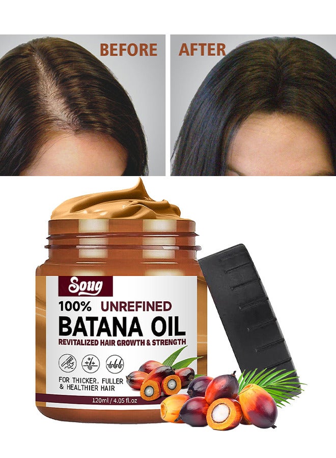 SOUG Batana Oil For Hair Growth Healthier Thicker Fuller Hair, Batana Oil For Hair Growth, Batana Oil Organic, Batana Oil Organic To Repair Dry Damaged And Frizzy Hair, Deep Repair Conditioning, 120ML - Image 1