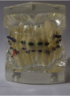 OrthoUnion Orthodontic Dental Demonstration Teeth Model Study Teaching Dental Model 