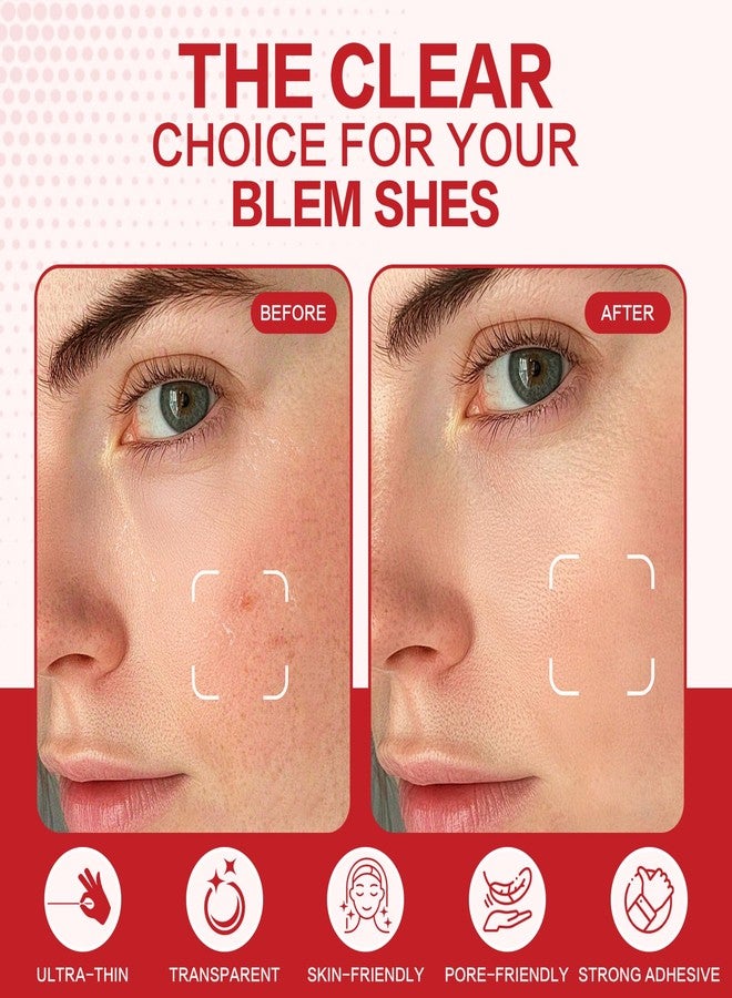 elesysy لصقات إيليسيسي للعناية بالبشرة، غير مرئية وقابلة للحمل، مناسبة للاستخدام المنزلي والسفر، لصقات لطيفة للعناية اليومية بالبشرة - علبتان - Image 2