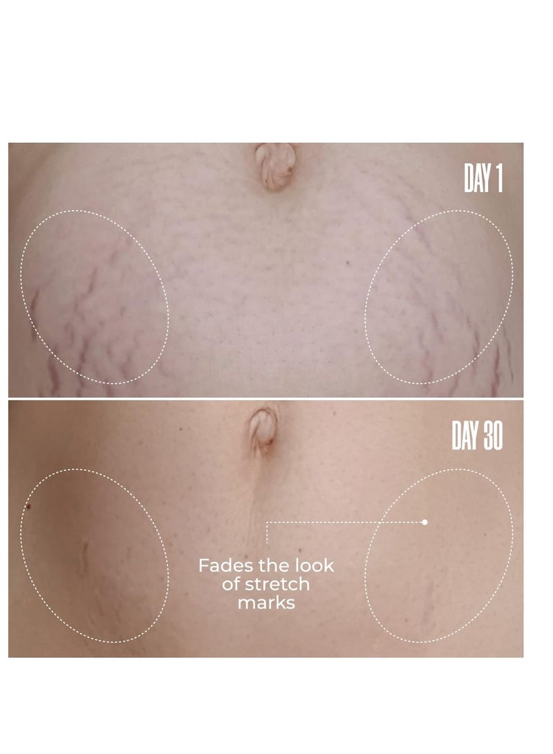 Maelys B-FLAT Belly Firming Cream Stretch Mark Belly Cream 3.38 oz - Image 4