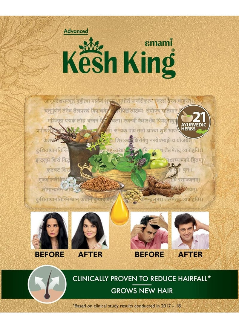 Kesh King - Herbal Indian oil 50ml - pzsku/ZD89804DB0A3388448743Z/45/_/1713938362/e4aaa06f-ef7c-4915-9a9e-5794b29c09a2