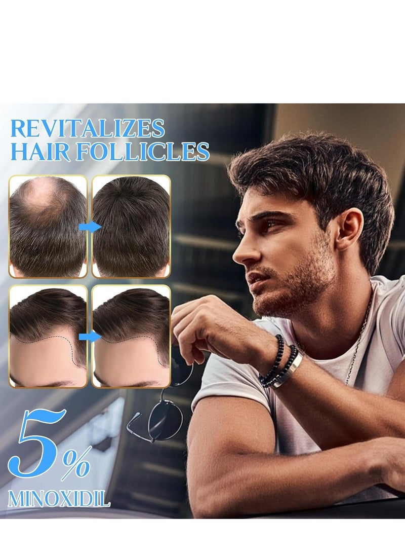 Sefudun 5% Minoxidil Hair Growth Spray for Men and Women, Reduces Thinning and Promotes Regrowth, Suitable for All Hair Types, 2.02 OZ - Image 2