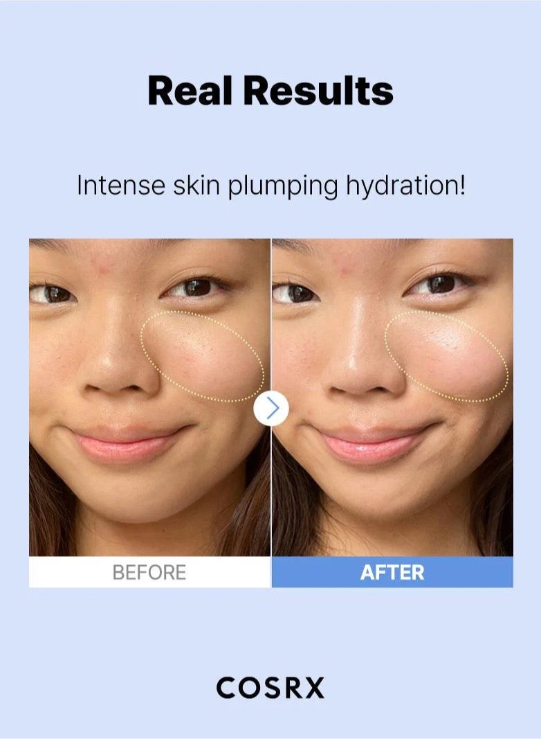 COSRX Hyaluronic Acid 3 Serum - Advanced Hydration Booster for Dewy, Radiant Skin - High Potency Formula Infused with 3% Hyaluronic Acid 20ml - Image 3