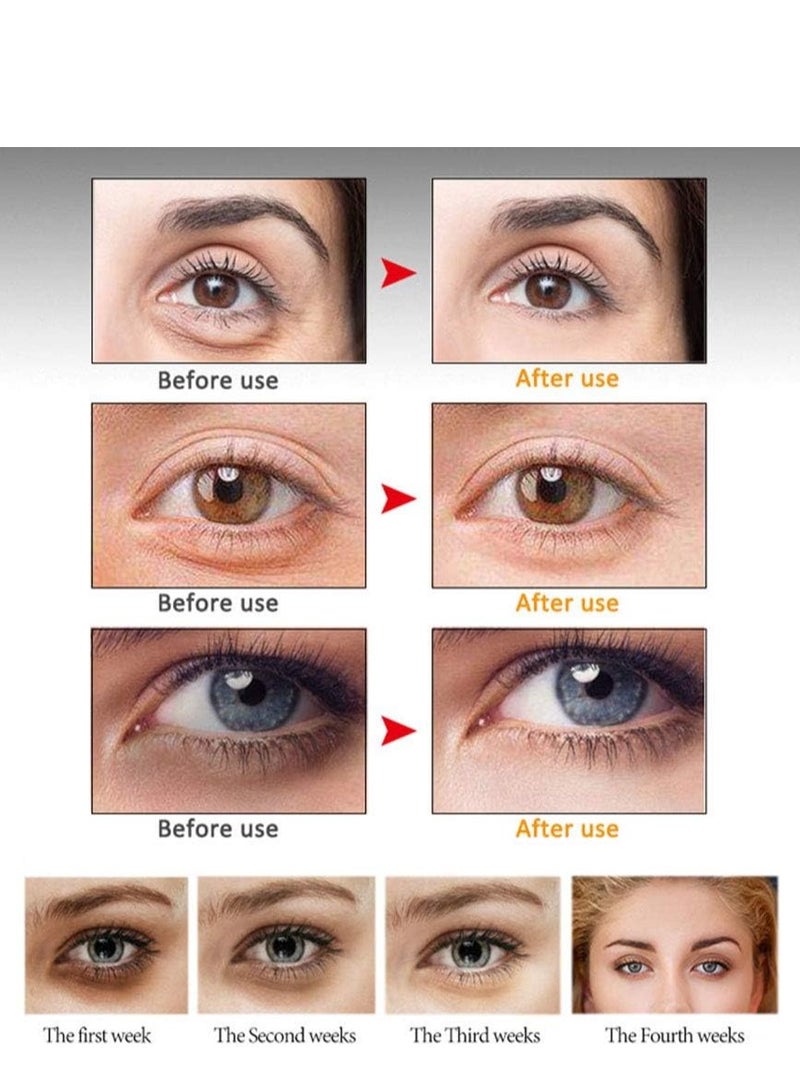 Generic Eye Peptide Serum Eye Massage Roller Nourishing Relieve Loose Eye Bags Dark Circles Eye Skin Care Under Eye Cream for Fine Wrinkles and Puffiness Daily Skincare(Nourishing Grey 20mL)  - Image 5
