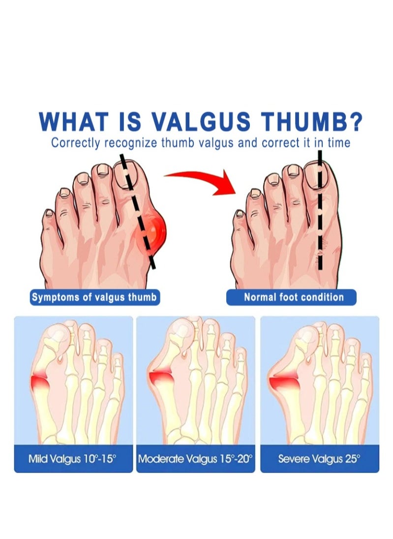 ERAYCEE - Bunion Pain Relief Patch,Strong Joints Bunion Patch,Bunion Pads,Bunion Corrector,Bunion Relief,Hallux Valgus And Overlapping Toes Naturally 8 Patch - Image 1