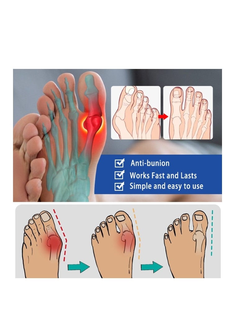 ERAYCEE - Bunion Pain Relief Patch,Strong Joints Bunion Patch,Bunion Pads,Bunion Corrector,Bunion Relief,Hallux Valgus And Overlapping Toes Naturally 8 Patch - Image 1