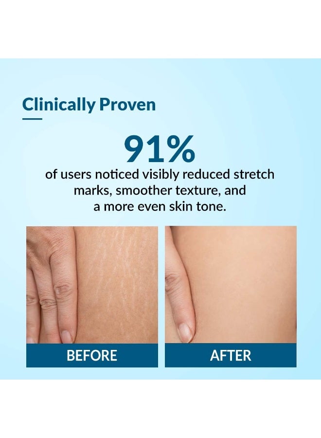 Fixderma Strallium Stretch Mark Cream, Removes Pregnancy stretch marks, Scar removal and Moisturizing Cream, Stretch mark remover for Stomach, thighs & all body parts- 75g - Image 4