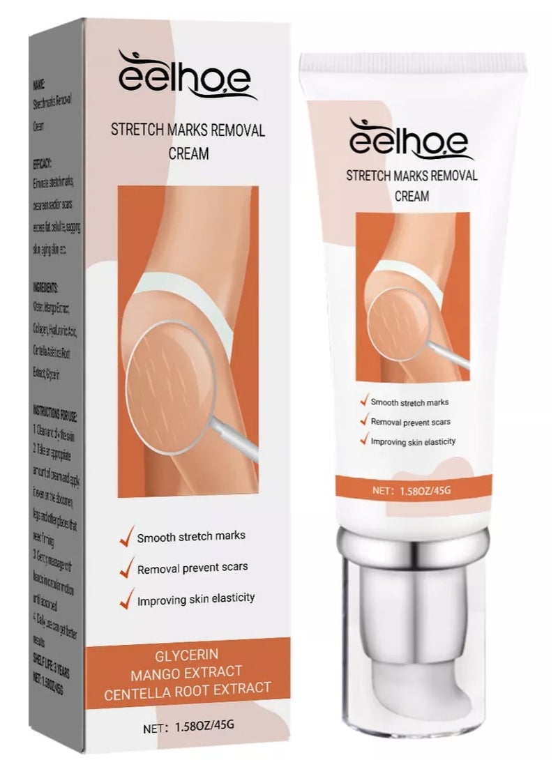 EELHOE كريم ديرمايز لإزالة علامات التمدد، كريم إزالة علامات التمدد، كريم ندبات علامات التمدد، جل كريم الندبات، كريم العناية بالندبات، يساعد في علاج علامات التمدد، الجراحة، الإصابات، وندبات الحروق - Image 2