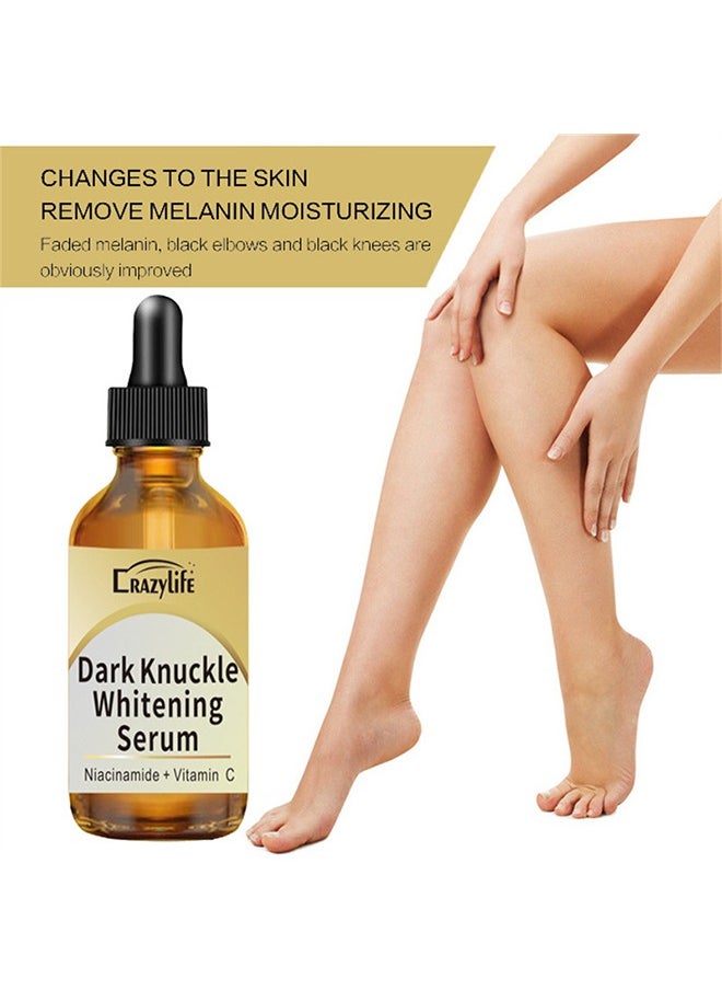Crazylife Dark Knuckle Whitening Serum, Joint Darkening Serum, Lighten And Repair Melanin, Skin Care Removal Body Bleaching For Knuckle Elbows 30ml  - Image 4