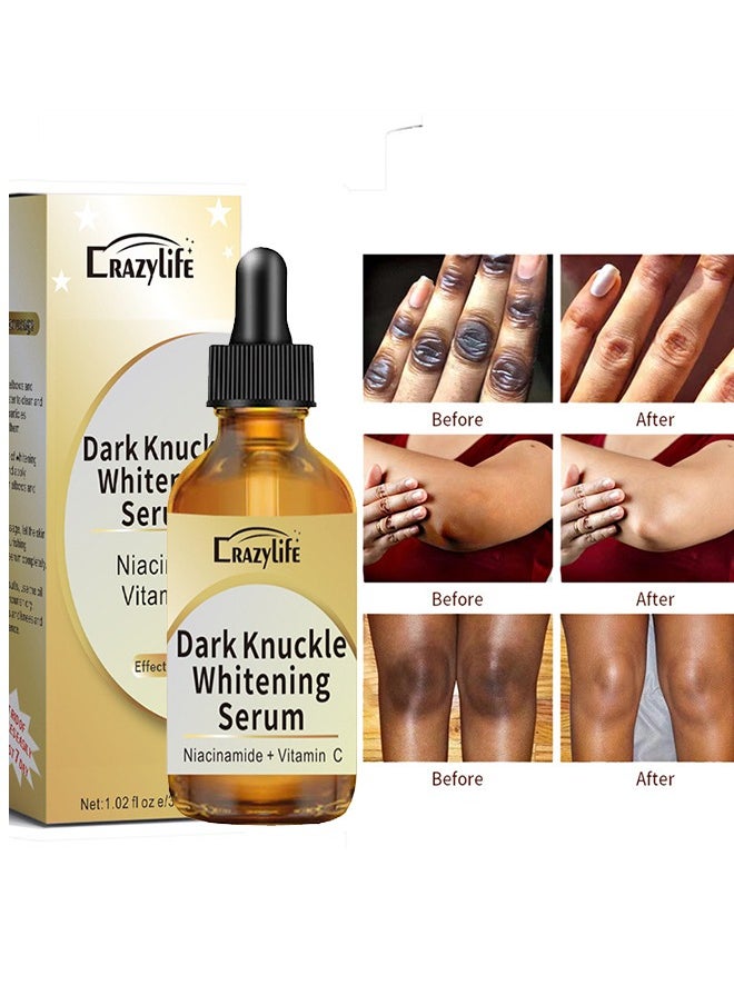Crazylife Dark Knuckle Whitening Serum, Joint Darkening Serum, Lighten And Repair Melanin, Skin Care Removal Body Bleaching For Knuckle Elbows 30ml  - Image 1