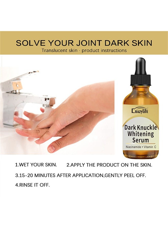 Crazylife Dark Knuckle Whitening Serum, Joint Darkening Serum, Lighten And Repair Melanin, Skin Care Removal Body Bleaching For Knuckle Elbows 30ml  - Image 5
